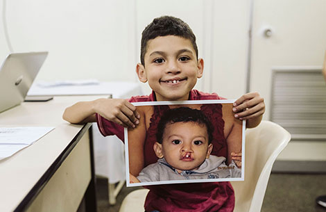 Smile Train Africa's 100000th patient